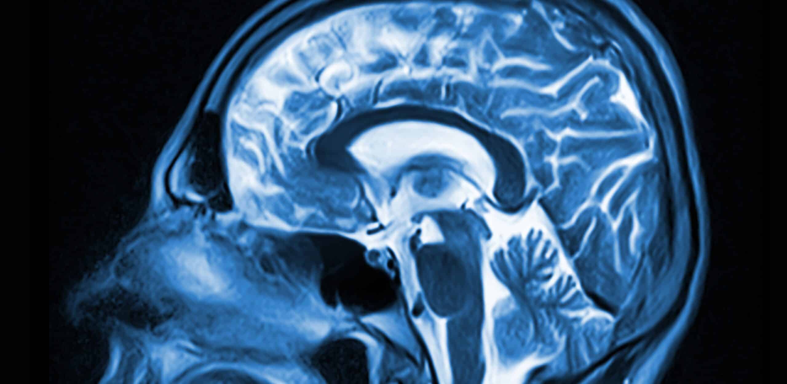 AdobeStock_1245040922-scaled